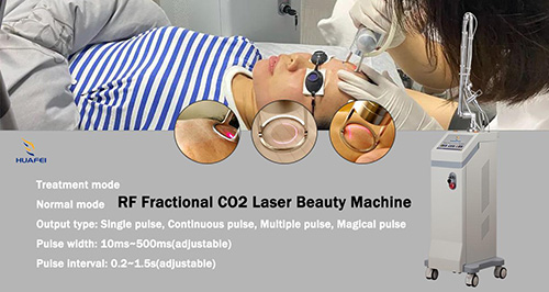 co2 laser for acne scars