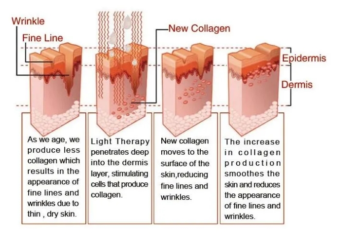 pdt led light therapy machine