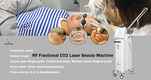 co2 laser for acne scars