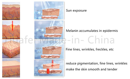 co2 fractional laser benefits