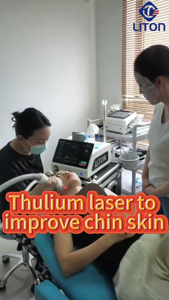 1927nm Thulium Laser Chin Skin Rejuvenation