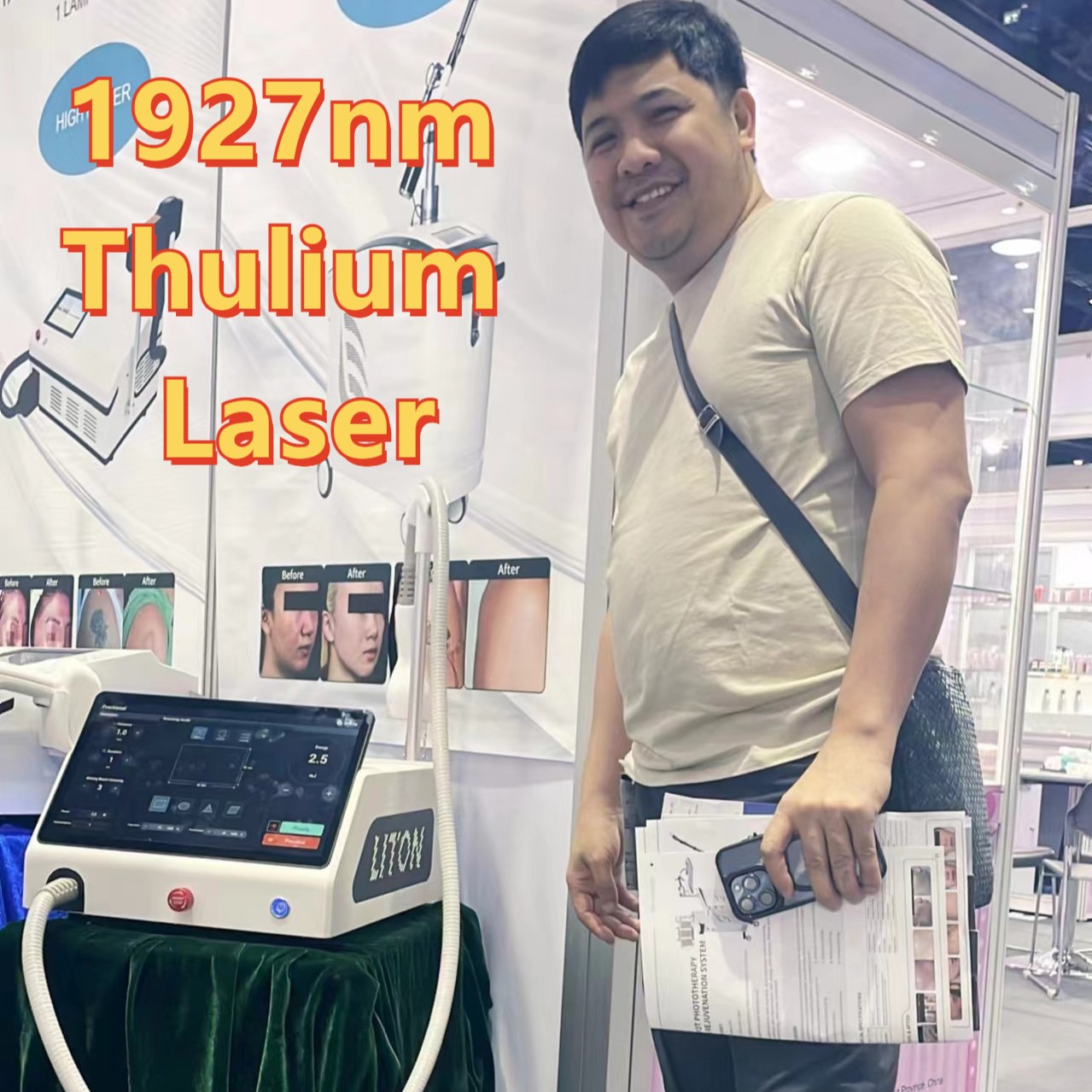Thulium Laser at Thailand Exhibition