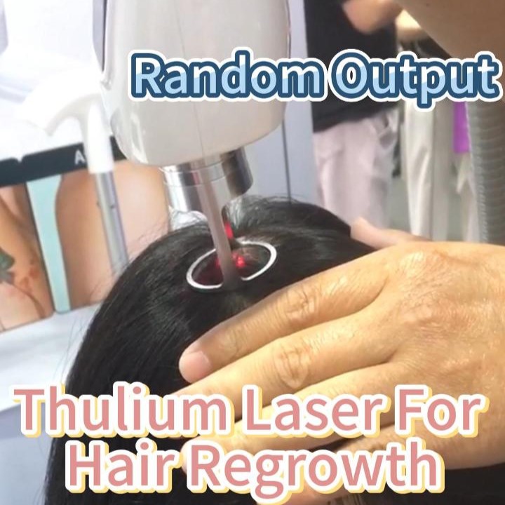 Thulium laser to prevent hair loss