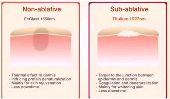 1550 nm erbium laser 1927nm thulium laser