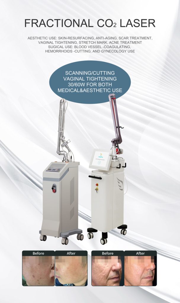 10600nm Fractional CO2 laser poster