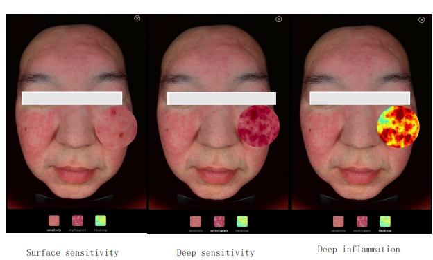 Analysis of detection dimensions - Local amplification function