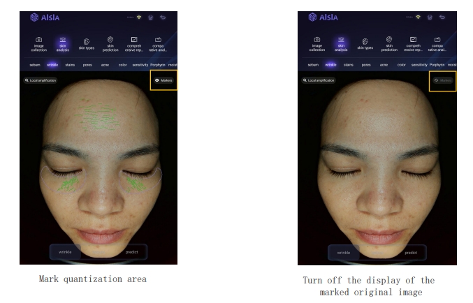 3d facial scanner