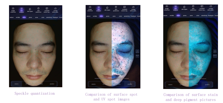 Analysis of detection dimensions - quantitative comparison of different skin layers