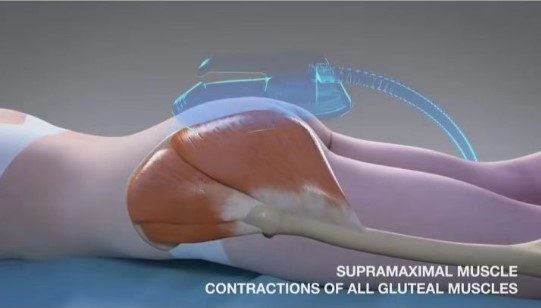 EMS sculpting muscle slimming machine working diagram