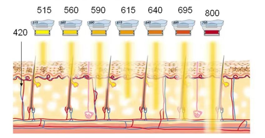 IPL filter handles for different wavelengths