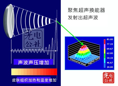 Ultrasonic anti-aging principle