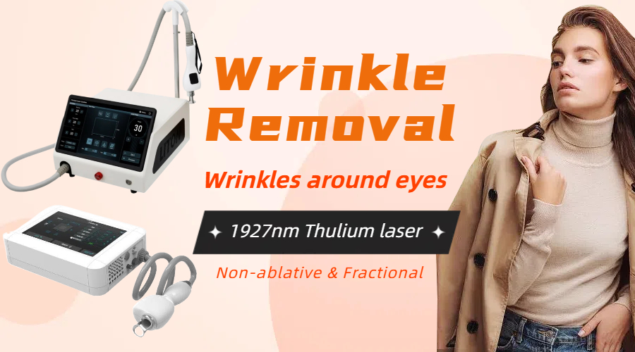 Non-ablative fractional 1927 nm thulium laser for wrinkle removal around the eyes