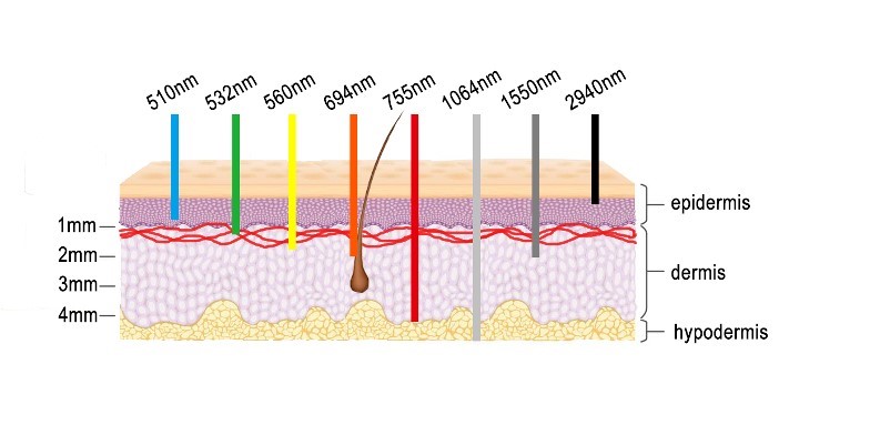 The depth of laser penetration into the skin at different wavelengths