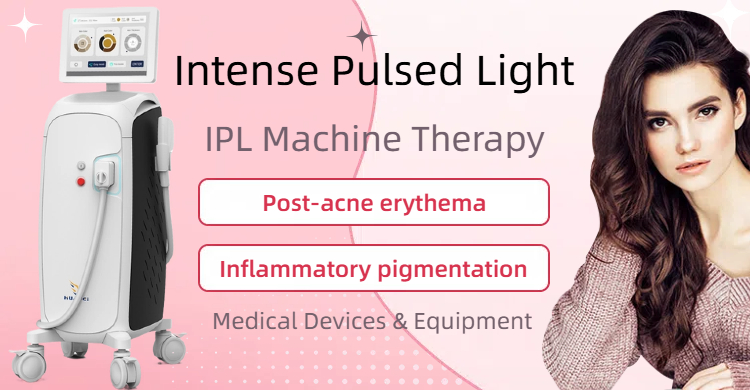 IPL Machine Treats Post-Acne Erythema and Inflammatory Pigmentation