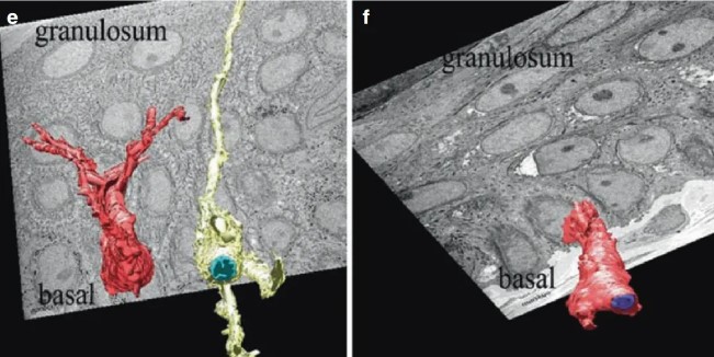 Laser treatment of melanin cell changes in chloasma