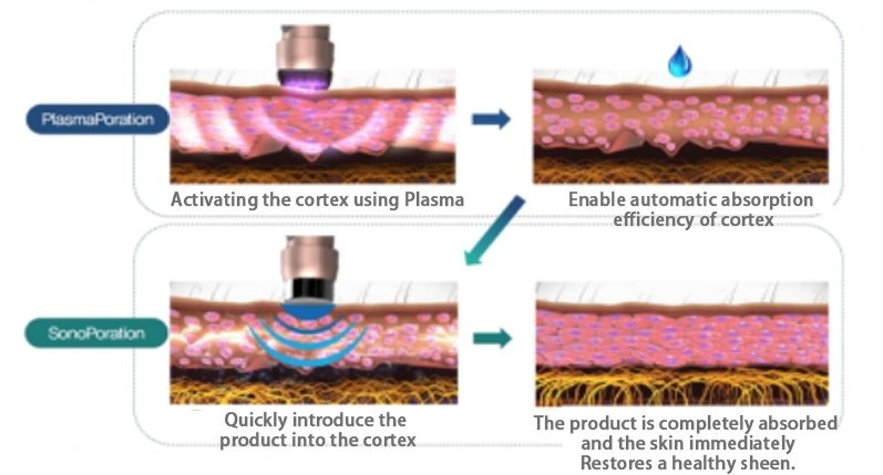 fractional plasma 3in 1 machine treatment principle for antiaging