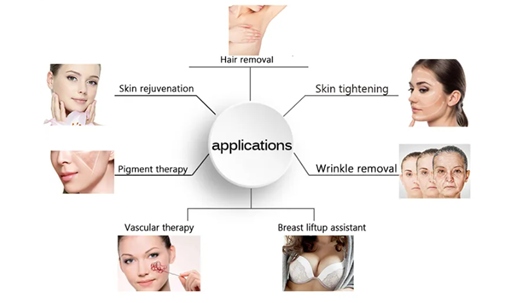 broadband light laser treatment