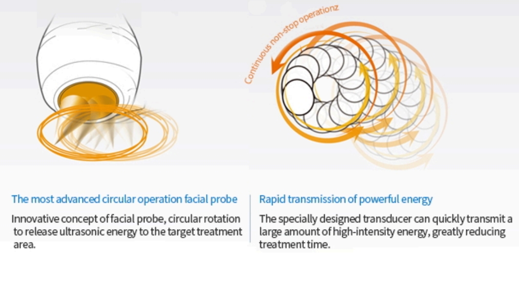 hifu treatment for face