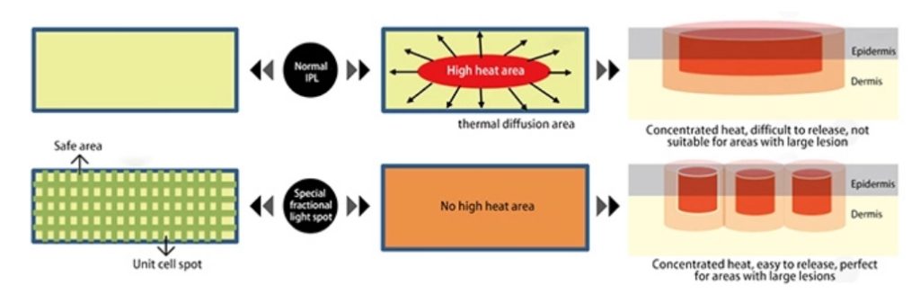 near infrared light therapy