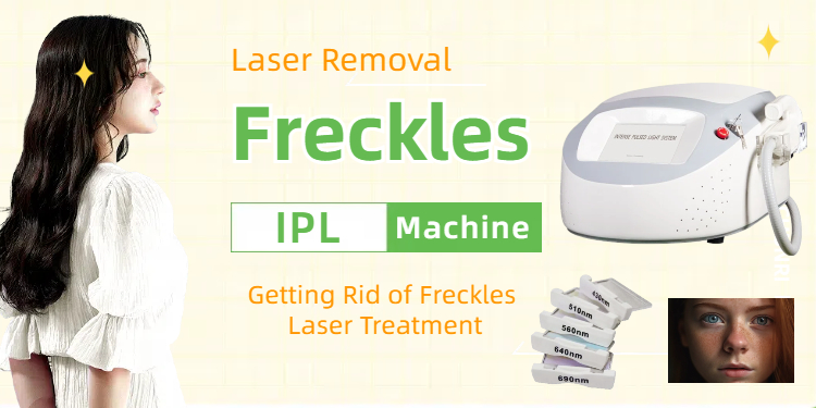 Getting rid of freckles laser treatment IPL facial device